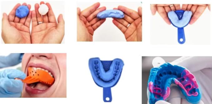 Dental impression material (1)